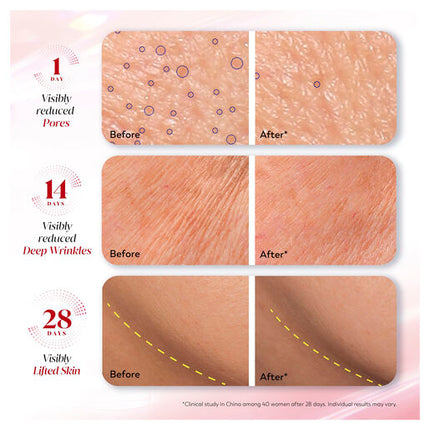 Olay Regenerist Anti Aging PHCA Bakuchiol Collagen Peptide Ultra Firming Serum 30mL