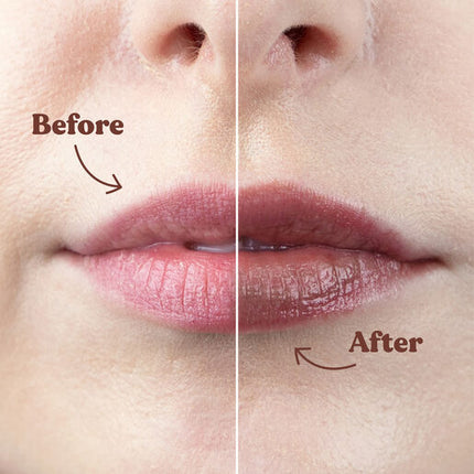 Dermal Therapy Tinted Lip Balm - Mocha Brown 8 g