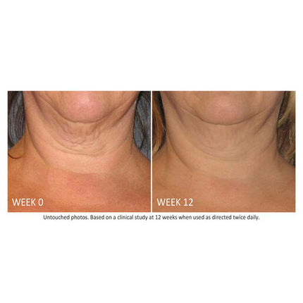 NEOSTRATA Skin Active Triple Firming Neck Cream 80g