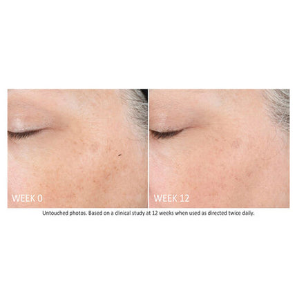 NEOSTRATA Skin Active Tri-Therapy Lifting Serum 30mL