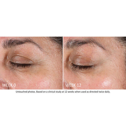 NEOSTRATA Skin Active Tri-Therapy Lifting Serum 30mL