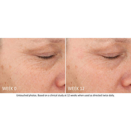 NEOSTRATA Skin Active Tri-Therapy Lifting Serum 30mL