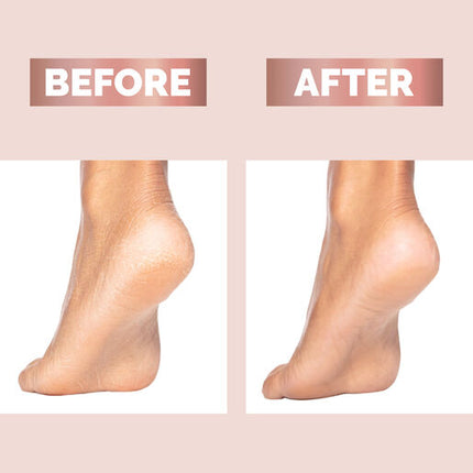 Finishing Touch Flawless Pedicure Tool