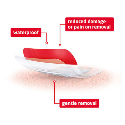 Leukomed T Plus Skin Sensitive 5 x 7.2cm 5 Pack