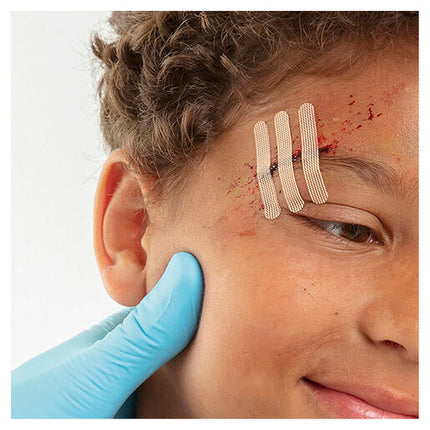 Leukosan Wound Closure Strips Assorted 9 Pack