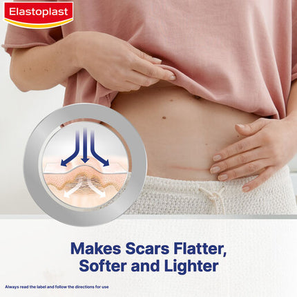 Elastoplast Scar Reducer XL 21 Pack