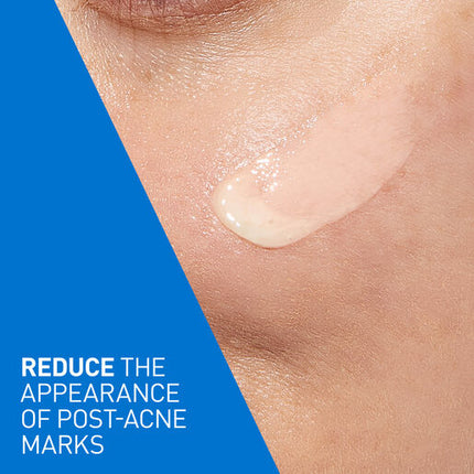 CeraVe Blemish Control Resurfacing Retinol Serum 30ml