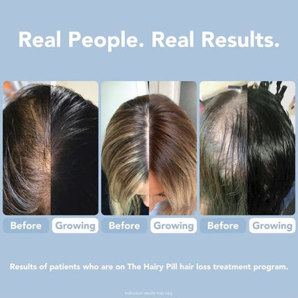 The Hairy Pill for Women