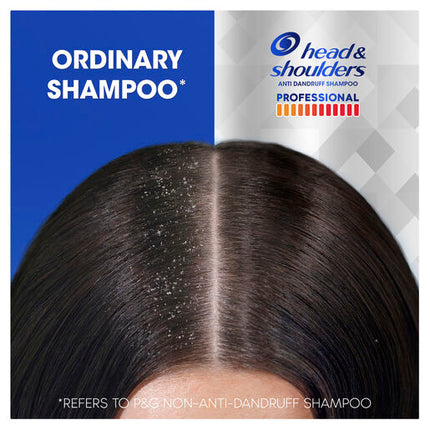 Head & Shoulders Professional Advanced Itch Care Shampoo for Severe Dandruff 300 ml