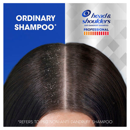 Head & Shoulders Professional Advanced Oil Control Shampoo for Severe Dandruff 300 ml