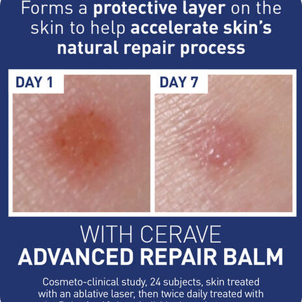 CeraVe Advanced Repair Balm 88ml