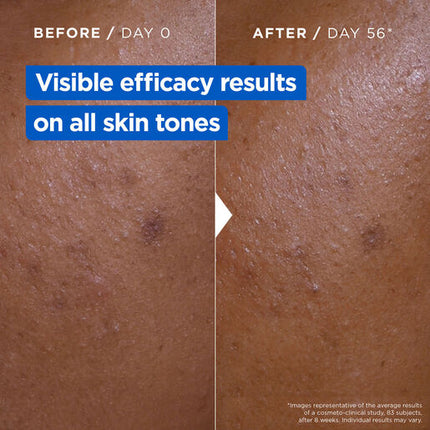 Mixa Niacinamide Bright 9% Moisturising Anti-Dark Spot Cream 400ml