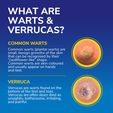Dr.Scholl's Freeze Away Max Verruca & Wart Remover