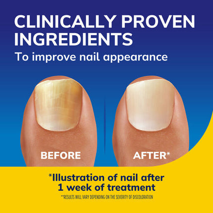 Dr.Scholl’s Nail Revitaliser Serum