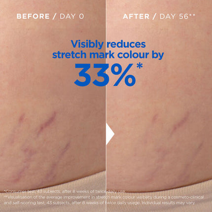 Mixa Stretch Mark Oil with Omega 6 & 9 Hypoallergenic 100ml