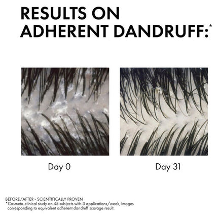Vichy Dercos Anti Dandruff DS Shampoo for Dry Hair 200ml