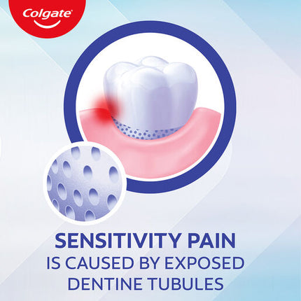 Colgate Toothpaste Sens Whitening 110G