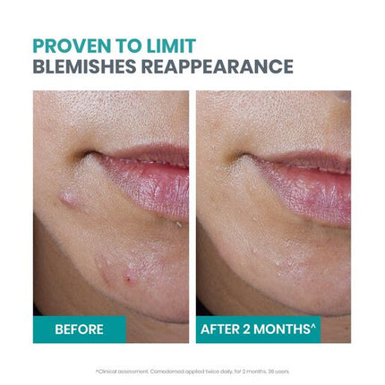 Avene Cleanance Starter Kit