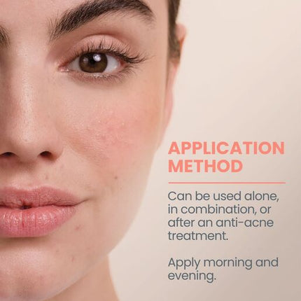 Avene Cleanance Comedomed 30ml