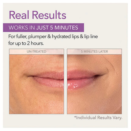 Skin Doctors Instant Lip Plumper 3ml