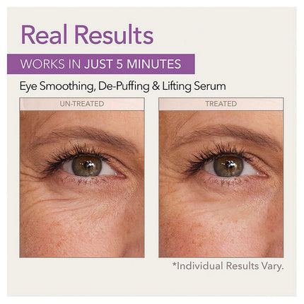 Skin Doctors Instant Eye Lift 10mL