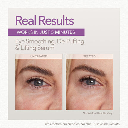 Skin Doctors Instant Eye Lift 10mL