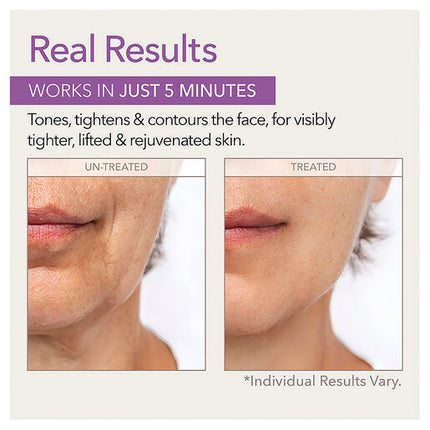 Skin Doctors Instant Facelift 30ml Cosmetic Facelift Without Surgery