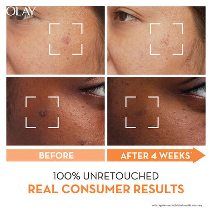 Olay Luminous Niacinamide Vitamin C Moist Cream 50g