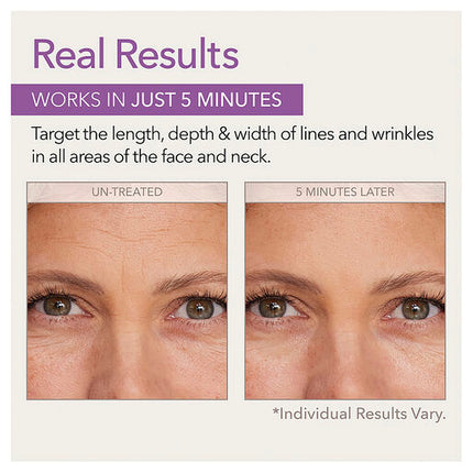 Skin Doctor Instant Wrinkle Filler 10mL