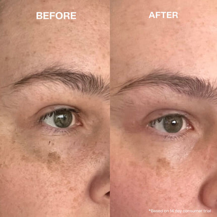Hey Bud Kojic Acid + Alpha Arbutin Pigmentation Treatment 30ml