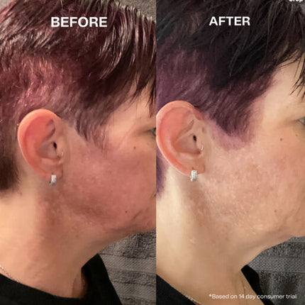 Hey Bud Kojic Acid + Alpha Arbutin Pigmentation Treatment 30ml