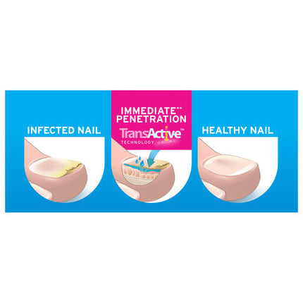 Excilor Fungal Nail Treatment Solution 3.3mL