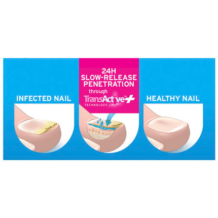 Excilor Fungal Nail Treatment Ultra 30ml