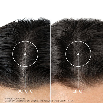 Klorane Strengthening Serum with Quinine and Organic Edelweiss 100ml - Thinning Hair