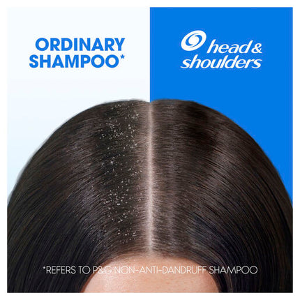 Head & Shoulders Itchy Scalp Care Anti Dandruff 2in1 Shampoo and Conditioner 350ml