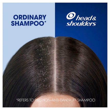 Head & Shoulders Ultra Men Sports Fresh: Mens 2in1 Anti Dandruff Shampoo and Conditioner 400ml