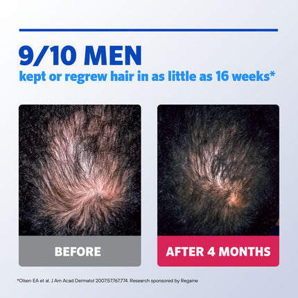 Regaine Mens Extra Strength 5% 1 Month 60Ml