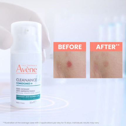 Avène Cleanance Comedomed+ Intensive Anti-Blemish Care 30ml