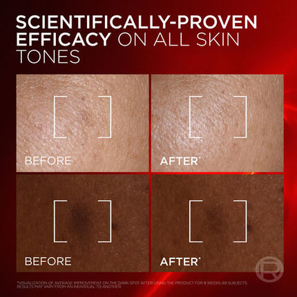 L'Oréal Paris Revitalift Laser Melasyl Creamy-Serum