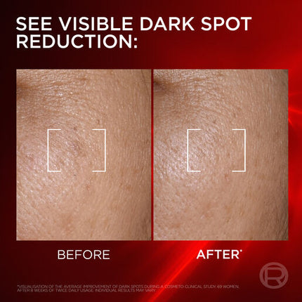 L'Oréal Paris Revitalift Laser Melasyl Creamy-Serum