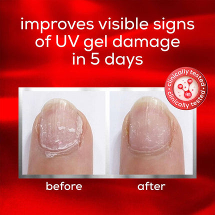 Essie To the Rescue Advanced Nail Treatment 13.5ml