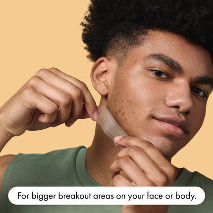 Hero Mighty Patch Surface Pimple Patches Face Body & Back XL-Sized 10 pack
