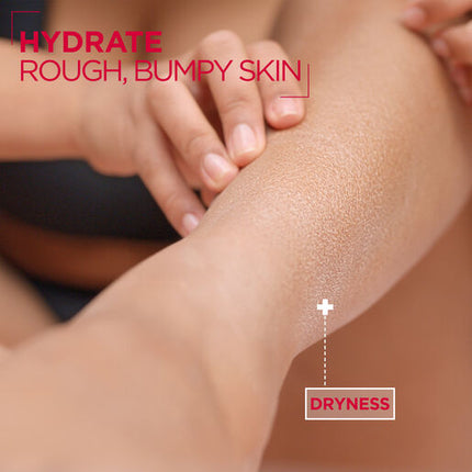 Mixa Urea Cica Repair+ Body Milk 400ml