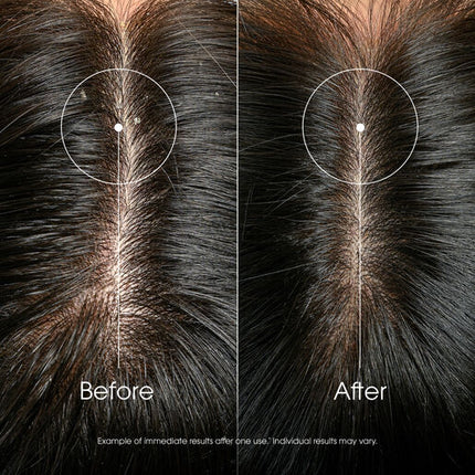 Anti-Dandruff Rebalancing & Treating Shampoo With Galangal 400mL