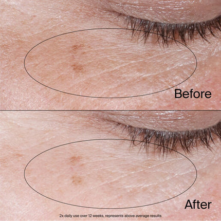 Neutrogena Collagen Bank Reviving Eye Gel Cream 14g